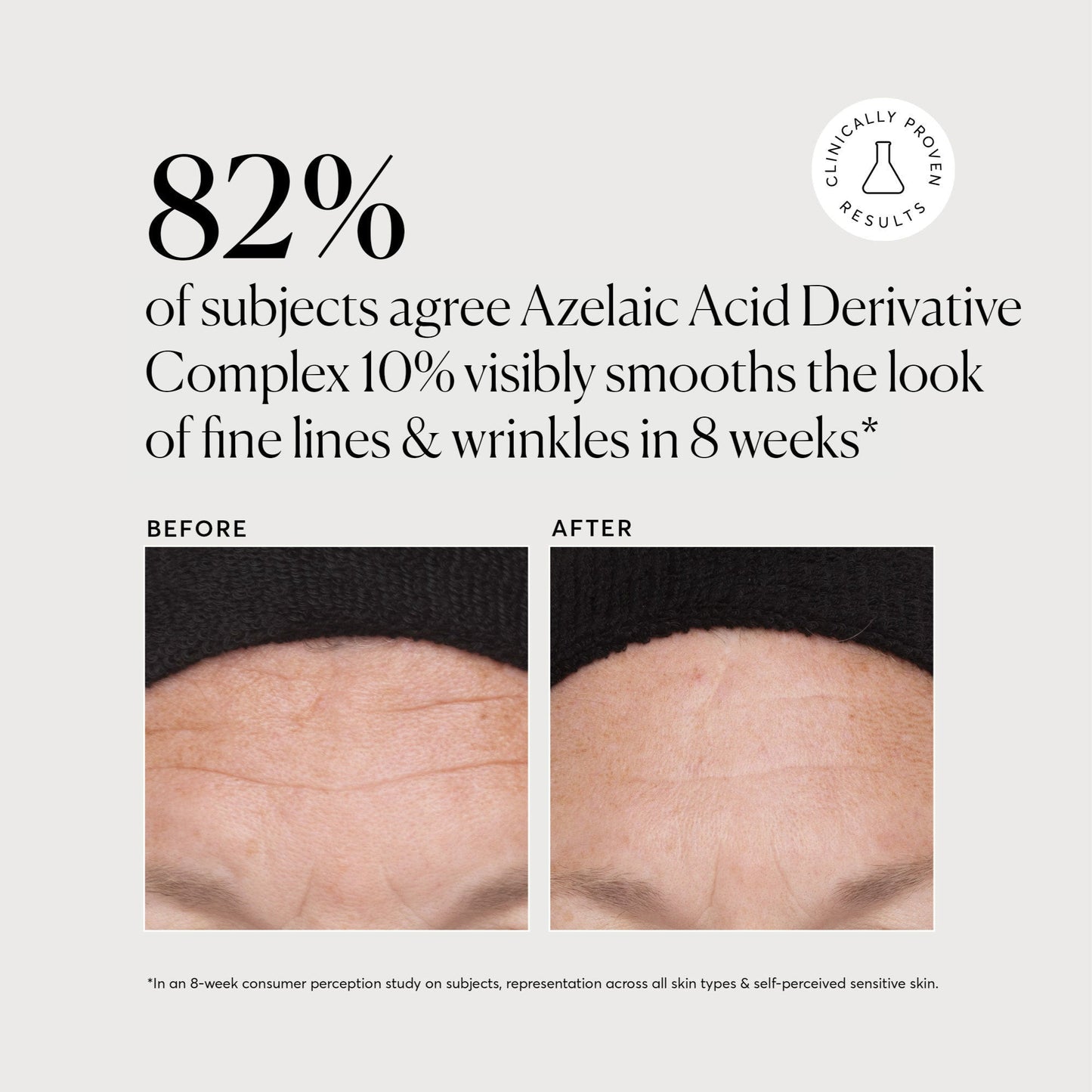 azelaic-acid-derivative-complex-10-jumbo-y9 NATR-10023-Alt-Images-Azelaic-Acid-Derivative-Complex-10_-043.jpg