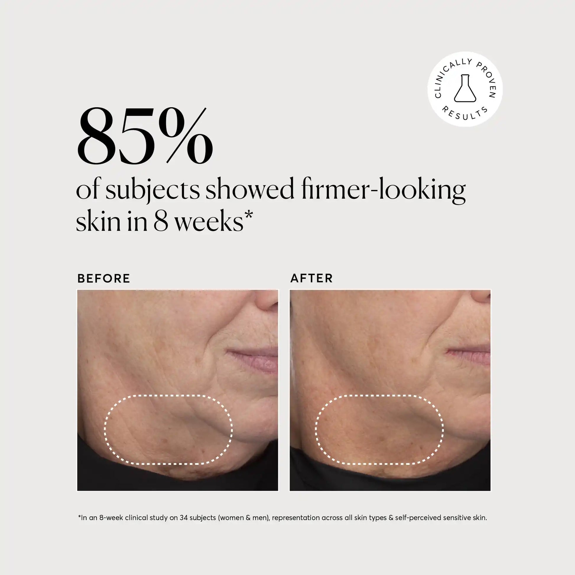 retinol-complex-serum-u4 NATR-10034-Alt-Images-Retinol-Complex-Serum-04.webp